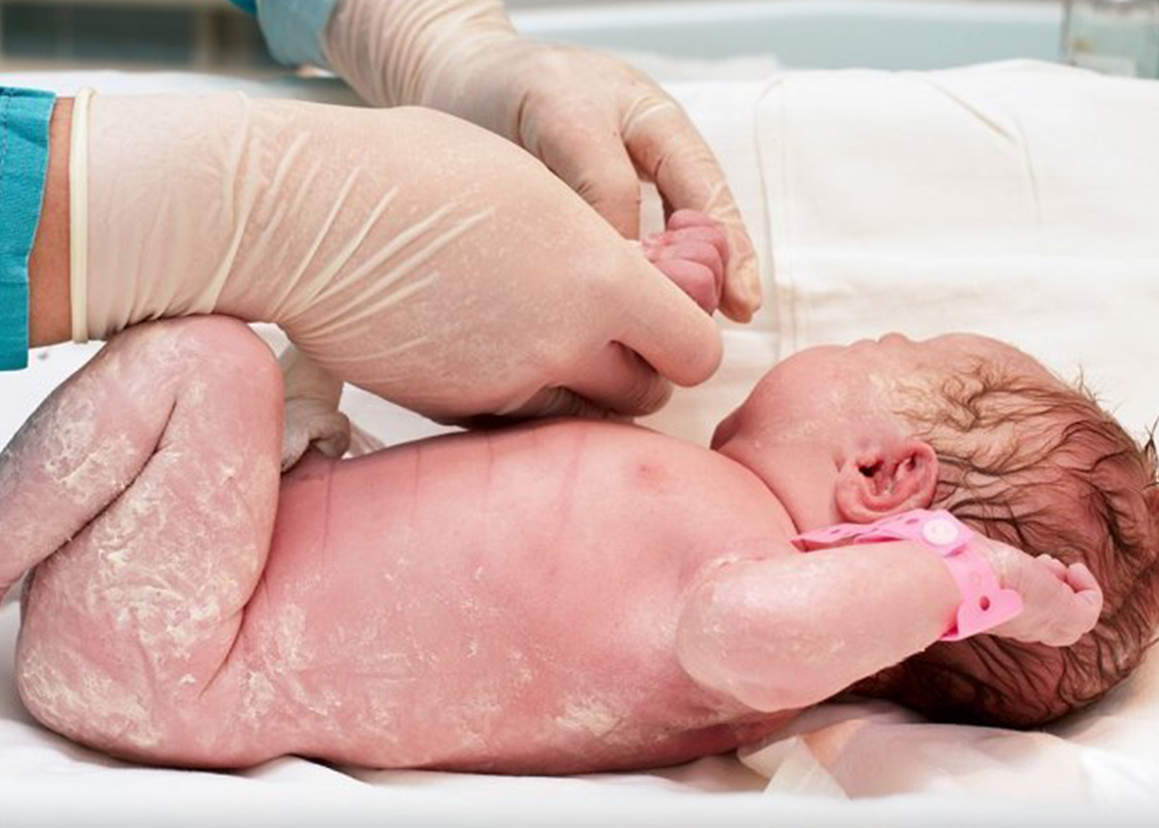 Cómo cuidar de la piel del recién nacido